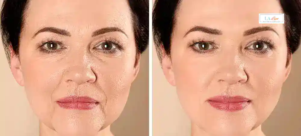 Why Aren’t My Skincare Products Making My Sagging Skin Look Firmer Newcastle-under-Lyme?